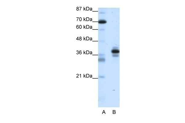 PITX1 Antibody Cat. No. 28813 ProSci