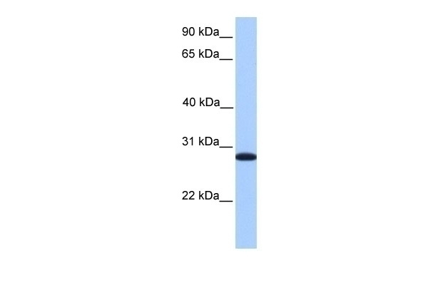 CDKN3 Antibody Cat. No. 30906 ProSci