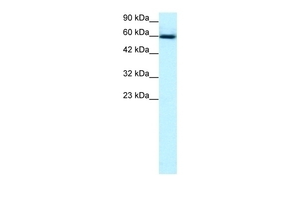 GABPA Antibody Cat. No. 31197 ProSci