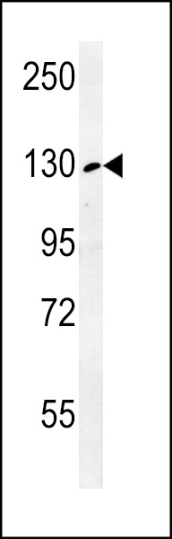 RTL1 Antibody - Cat. No. 55-002 | ProSci