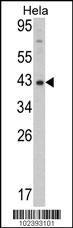 Mouse Dnmt3L Antibody - Cat. No. 55-295 | ProSci