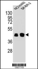 KRT80 Antibody Cat. No. 55483 ProSci