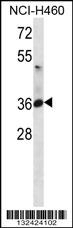 ATP1B3 Antibody Cat. No. 56621 ProSci