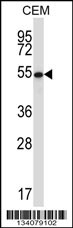 GABPA Antibody Cat. No. 57435 ProSci