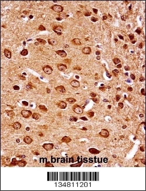 Mouse Map2k7 Antibody - Cat. No. 57-518 | ProSci