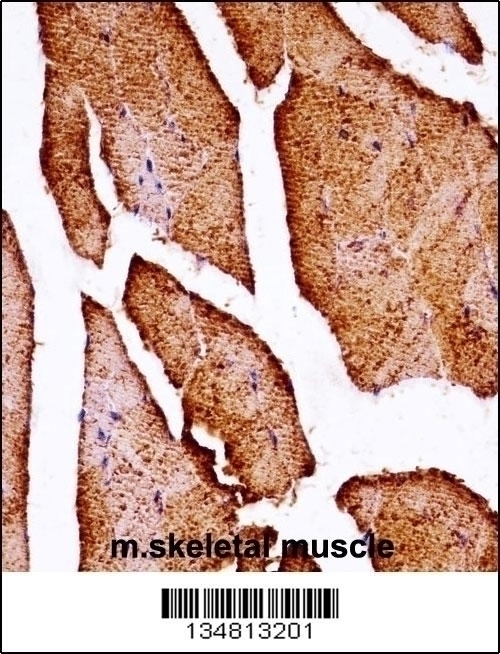 Mouse Map3k10 Antibody - Cat. No. 57-602 | ProSci