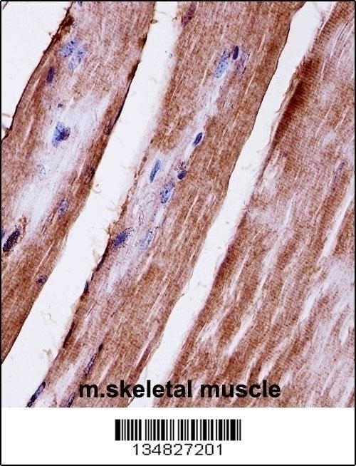 Mouse Mapk3 Antibody - Cat. No. 57-603 | ProSci