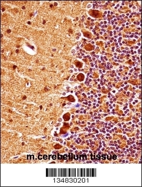 Mouse Mapk9 Antibody - Cat. No. 57-741 | ProSci