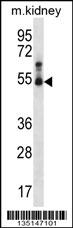 Mouse Stk32b Antibody - Cat. No. 57-978 | ProSci