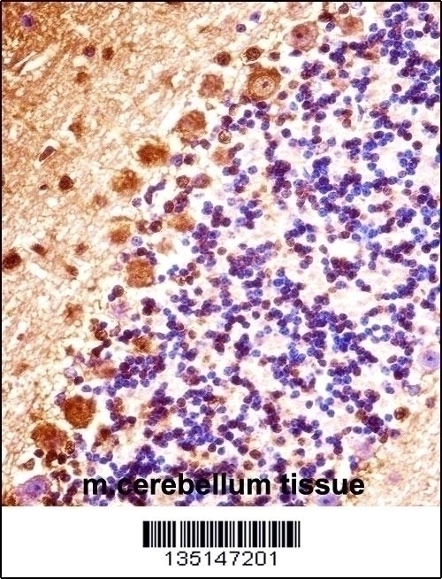 Mouse Stk32b Antibody - Cat. No. 57-978 | ProSci
