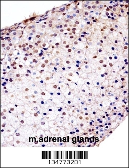 Mouse Fgfr1 Antibody - Cat. No. 58-030 | ProSci