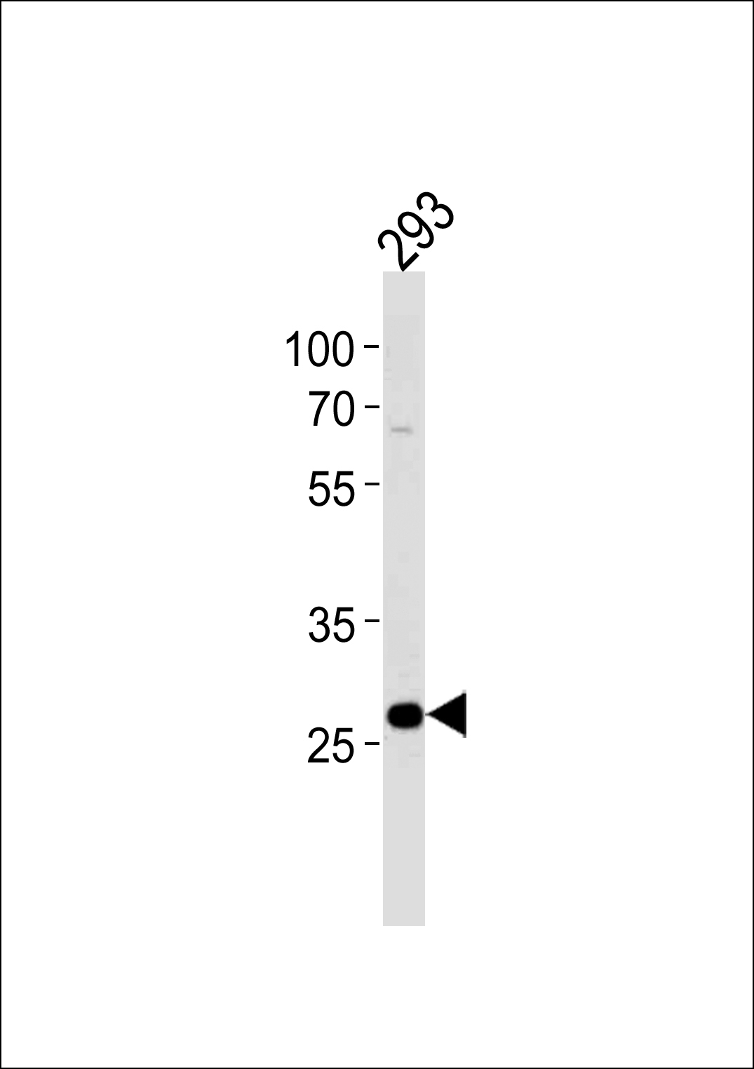 PRB4 Antibody - Cat. No. 61-018 | ProSci