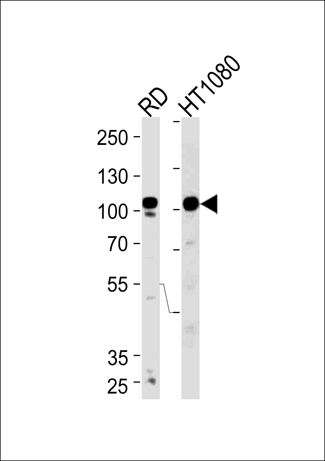 ATP2A1 Antibody Cat. No. 61704 ProSci