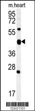 ACSF3 Antibody Cat. No. 62100 ProSci