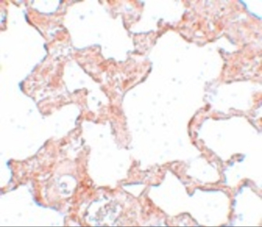 VLK Antibody - Cat. No. 5561 | ProSci