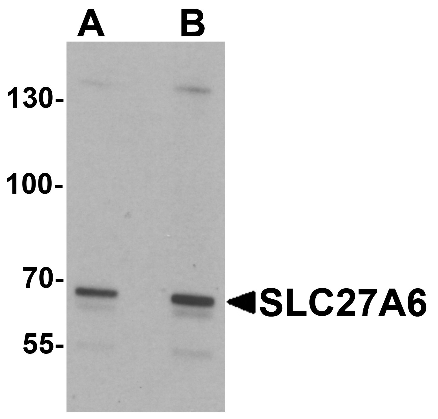 SLC27A6 Antibody Cat. No. 7297 ProSci