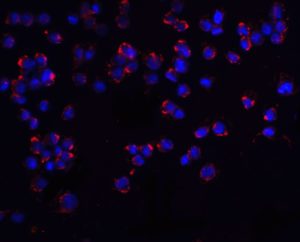 PUMA antibody (Cat. No. 3043): Immunofluorescence Validation of PUMA in K562 Cell