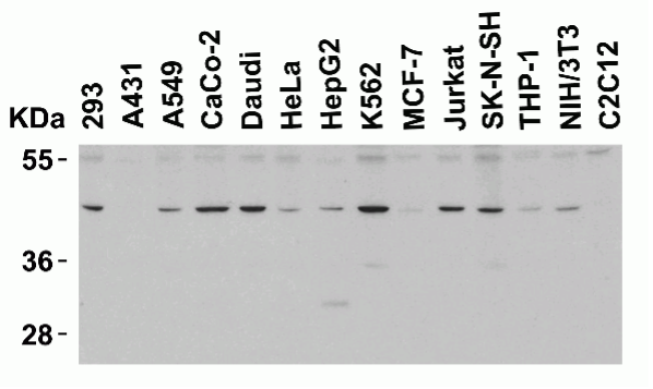 PD-1: Expanding Beyond Cancer Research | ProSci