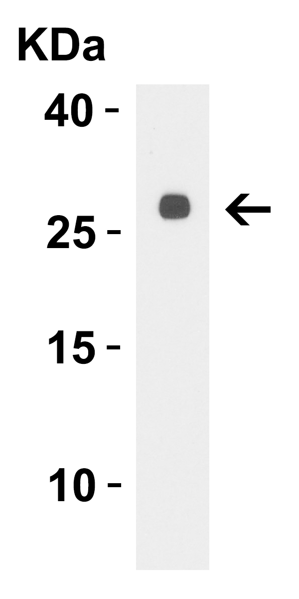 LpxT Antibody ProSci Incorporated