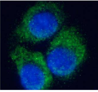 A2A-Adenosine Receptor Antibody [Ig2838], Mouse IgG1 | ProSci Incorporated