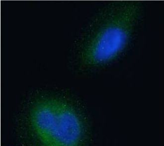 BACE2 Antibody [1/ 9], Mouse IgG1 | ProSci Incorporated