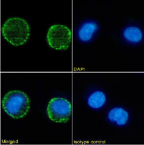 CD37 Antibody [MB-1], Mouse IgG1 | ProSci Incorporated