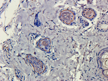 CD4 Antibody [MT310], Mouse IgG1 | ProSci Incorporated