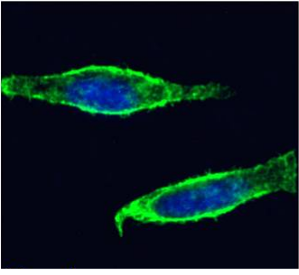 CD98 Antibody [CP1-5], Mouse IgG1 | ProSci Incorporated