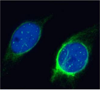 Membrane type 1 metalloprotease Antibody [LEM-2/15], Mouse IgG1 ...