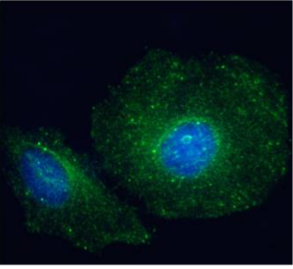 Paxillin (LD4 Motif) Antibody [LD4 sAB], Mouse IgG1 | ProSci Incorporated