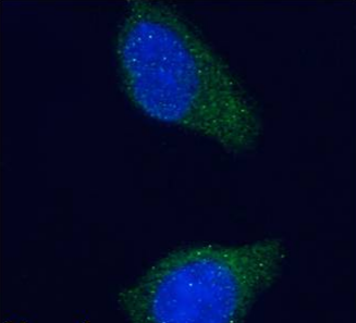tau Antibody [Tau-5], Mouse IgG1 | ProSci Incorporated