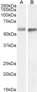 BACE2 Antibody [1/ 9], Mouse IgG1 | ProSci Incorporated