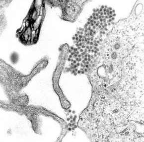 Dengue Virus