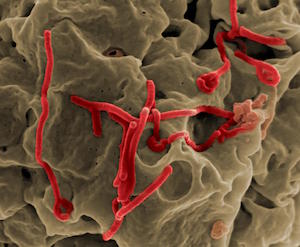Ebola Vaccine