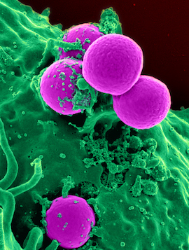 MRSA Antibiotic in Noses