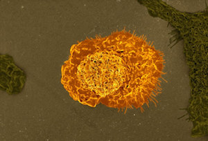Macrophage movement