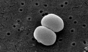 Staphylococcus epidermidis antibiotics
